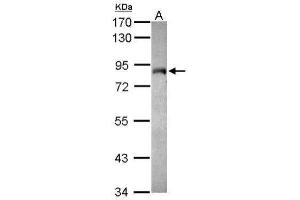 WB Image Sample (30 ug of whole cell lysate) A: MCF-7 7. (MYST2 antibody  (Internal Region))