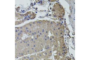 Immunohistochemistry of paraffin-embedded human stomach using UBE2S antibody. (UBE2S antibody  (AA 122-221))