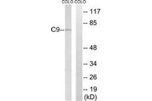 Western blot analysis of extracts from COLO cells, using C9 Antibody. (C9 antibody  (AA 181-230))