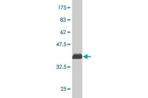 Western Blot detection against Immunogen (35. (CDK4 antibody  (AA 211-303))