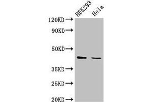 Western Blot Positive WB detected in: HEK293 whole cell lysate, Hela whole cell lysate All lanes: LPGAT1 antibody at 3 μg/mL Secondary Goat polyclonal to rabbit IgG at 1/50000 dilution Predicted band size: 44 kDa Observed band size: 44 kDa (LPGAT1 antibody  (AA 151-341))