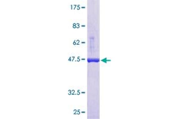 APRT Protein (AA 1-180) (GST tag)