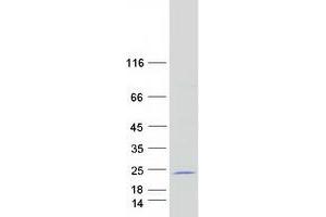 Validation with Western Blot (MORN5 Protein (Myc-DYKDDDDK Tag))