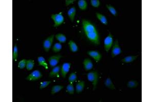 Immunofluorescence staining of A549 cells with ABIN7163123 at 1:200, counter-stained with DAPI. (ABCB4 antibody  (AA 530-693))