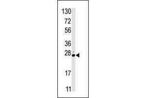 Western blot analysis of anti-STK19 Pab in HL60 cell line lysate (35 µg/lane). (STK19 antibody  (C-Term))