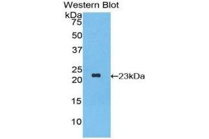 Western blot analysis of the recombinant protein. (IFNA2 antibody  (AA 24-188))