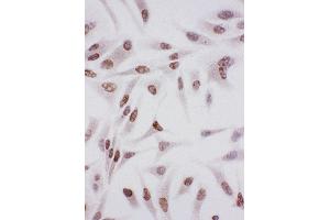 Anti-Ku70 antibody, ICC ICC: HELA Cell