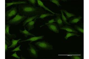 Immunofluorescence (IF) image for anti-Nudix (Nucleoside Diphosphate Linked Moiety X)-Type Motif 5 (NUDT5) (AA 1-219) antibody (ABIN524595)