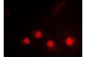 Immunofluorescent analysis of SMARCAD1 staining in HepG2 cells. (SMARCAD1 antibody)
