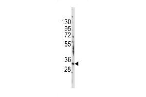 Western blot analysis of anti-STAP1 Antibody (F56) in mouse kidney tissue lysates (35ug/lane) (STAP1 antibody  (N-Term))