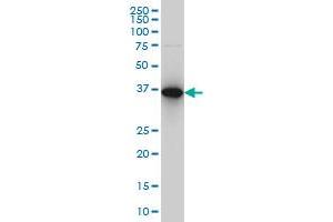 CAPG monoclonal antibody (M02), clone 6D6 Western Blot analysis of CAPG expression in Hela S3 NE . (CAPG antibody  (AA 249-348))