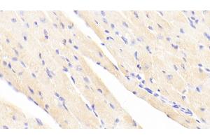 Detection of ACTN2 in Mouse Cardiac Muscle Tissue using Polyclonal Antibody to Actinin Alpha 2 (ACTN2) (ACTN2 antibody  (AA 1-254))