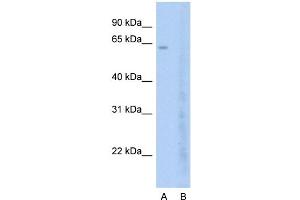 Host:  Rabbit  Target Name:  BRD7  Sample Type:  Jurkat  Lane A:  Primary Antibody  Lane B:  Primary Antibody + Blocking Peptide  Primary Antibody Concentration:  2. (BRD7 antibody  (C-Term))