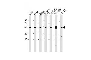 All lanes : Anti-TUBA4A Antibody (C-term) at 1:8000 dilution Lane 1: A431 whole cell lysate Lane 2: Hela whole cell lysate Lane 3: Jurkat whole cell lysate Lane 4: MCF-7 whole cell lysate Lane 5: NIH/3T3 whole cell lysate Lane 6: Mouse brain lysate Lane 7: PC-12 whole cell lysate Lysates/proteins at 20 μg per lane.