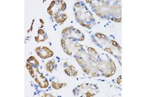 Immunohistochemistry of paraffin-embedded human stomach using NAA10 antibody. (NAA10 antibody)