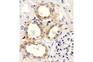 Antibody staining EGF in Human kidney tissue sections by Immunohistochemistry (IHC-P - paraformaldehyde-fixed, paraffin-embedded sections).