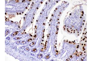 IHC analysis of MUC2 using anti-MUC2 antibody . (MUC2 antibody)