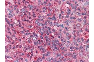 Human Spleen: Formalin-Fixed, Paraffin-Embedded (FFPE) (BIRC3 antibody)