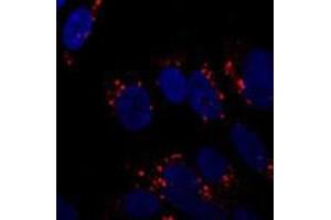 Immunofluorescent staining of ATG5 on SH-SY5Y cells using ATG5 polyclonal antibody  at 1 : 250. (ATG5 antibody  (AA 1-50))