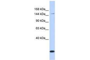Image no. 1 for anti-ATP-Binding Cassette, Sub-Family C (CFTR/MRP), Member 3 (ABCC3) (AA 684-733) antibody (ABIN6740834) (ABCC3 antibody  (AA 684-733))