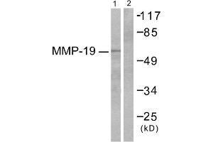 Western blot analysis of extracts from HuvEc cells, using MMP-19 antibody (ABIN2843550). (MMP19 antibody  (N-Term))