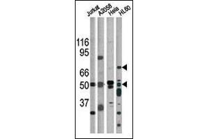 The anti-Phospho-CHK1- Pab (ABIN391324 and ABIN2841354) is used in Western blot for detection in, from left to right, Jurkat, , Hela, and HL60 tissue lysates. (CHEK1 antibody  (pSer317))