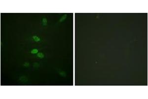 Immunofluorescence (IF) image for anti-Cell Division Cycle 25 Homolog B (S. Pombe) (CDC25B) (AA 319-368) antibody (ABIN1532566)