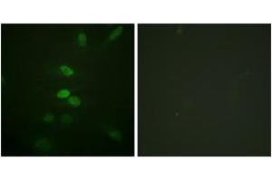 Immunofluorescence analysis of HeLa cells, using CDC25B (Ab-353) Antibody. (CDC25B antibody  (AA 319-368))