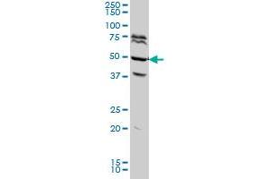 FOXA2 monoclonal antibody (M04A), clone 7G10 Western Blot analysis of FOXA2 expression in HeLa . (FOXA2 antibody  (AA 363-457))