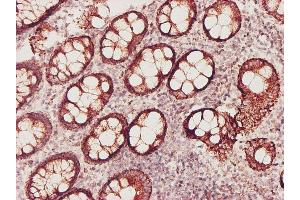 Immunoperoxidase of monoclonal antibody to GSS on formalin-fixed paraffin-embedded human colon tissue. (Glutathione Synthetase antibody)