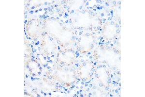 Immunohistochemistry (IHC) image for anti-Lysosomal-Associated Membrane Protein 2 (LAMP2) antibody (ABIN7268345)