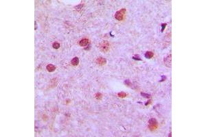 Immunohistochemical analysis of NFYC staining in human brain formalin fixed paraffin embedded tissue section. (NFYC antibody  (N-Term))