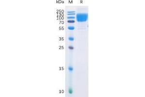 Human B7-2 Protein, mFc-His Tag on SDS-PAGE under reducing condition. (CD86 Protein (CD86) (mFc-His Tag))