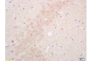 Formalin-fixed and paraffin embedded rat brain labeled with Rabbit Anti SULT1E1/Estrogen Sulfotranferase Polyclonal Antibody, Unconjugated (ABIN671106) at 1:200 followed by conjugation to the secondary antibody and DAB staining (SULT1E1 antibody  (AA 51-145))