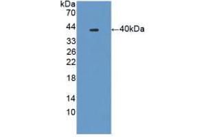Western blot analysis of recombinant Mouse PLA2R1.