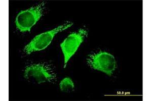 Immunofluorescence of purified MaxPab antibody to DNAJA3 on HeLa cell. (DNAJA3 antibody  (AA 1-480))