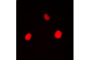 Immunofluorescent analysis of Hexokinase 1 staining in HEK293T cells. (Hexokinase 1 antibody  (N-Term))
