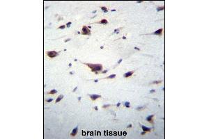 Immunohistochemistry (Paraffin-embedded Sections) (IHC (p)) image for anti-Phosphatidylinositol-3,4,5-Trisphosphate-Dependent Rac Exchange Factor 1 (PREX1) (AA 1134-1163), (C-Term) antibody (ABIN656506)