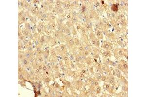 Immunohistochemistry of paraffin-embedded human liver tissue using ABIN7169647 at dilution of 1:100 (SRP19 antibody  (AA 2-144))