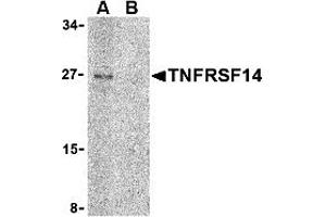 Western Blotting (WB) image for anti-Tumor Necrosis Factor Receptor Superfamily, Member 14 (TNFRSF14) (C-Term) antibody (ABIN1030760) (HVEM antibody  (C-Term))