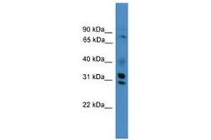 Image no. 1 for anti-GIPC PDZ Domain Containing Family, Member 3 (GIPC3) (AA 221-270) antibody (ABIN6745447) (GIPC3 antibody  (AA 221-270))