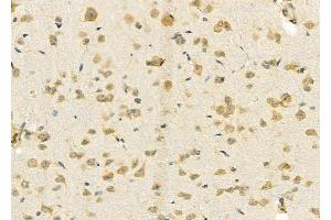 ABIN6257639 and ABIN6274782 at 1/100 staining Rat brain tissue by IHC-P. (RPL39 antibody  (C-Term))