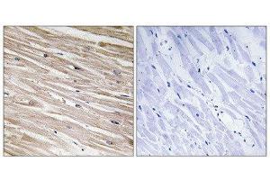 Immunohistochemistry (IHC) image for anti-phosphoprotein Enriched in Astrocytes 15 (PEA15) (pSer104) antibody (ABIN1847322)