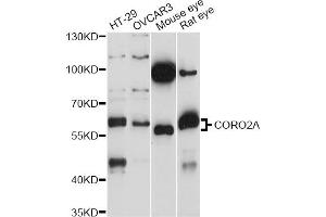 Western blot analysis of extracts of various cell lines, using CORO2A antibody (ABIN6293915) at 1:1000 dilution.