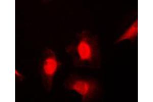 Immunofluorescent analysis of HSC70 staining in NIH3T3 cells. (Hsc70 antibody  (Center))