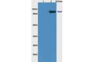 L1 rat brain lysates L2 rat kidney lysates probed with Anti Trk B/NTRK2 Polyclonal Antibody, Unconjugated (ABIN725870) at 1:200 overnight at 4 °C. (TRKB antibody  (AA 401-500))