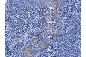 ABIN6255771 and ABIN6267262 at 1/100 staining human normal tonsil tissue by IHC-P. (EGFR antibody  (pTyr1068, pTyr1092))