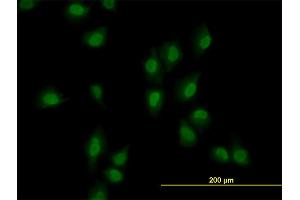 Immunofluorescence of monoclonal antibody to ARID1B on HeLa cell. (ARID1B antibody  (AA 1364-1460))