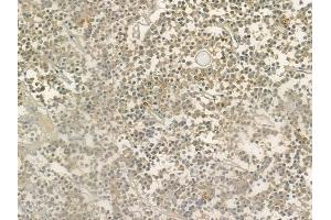 ABIN6264533 and ABIN6276573 at 1/100 staining human pituitary adenoma by IHC-P. (PYCARD antibody  (N-Term))