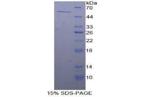 SDS-PAGE analysis of Rat ALDH7A1 Protein.